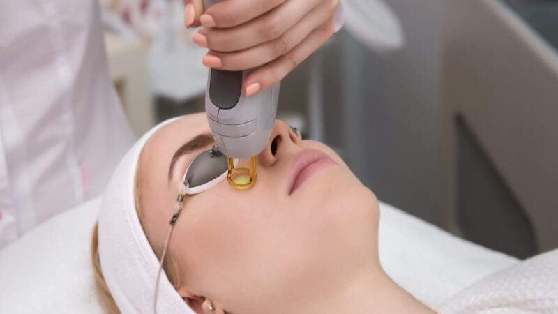 Laser Treatment